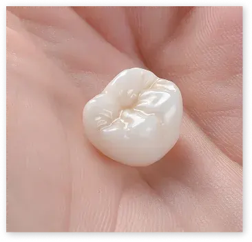 Dental crowns to restore damaged teeth